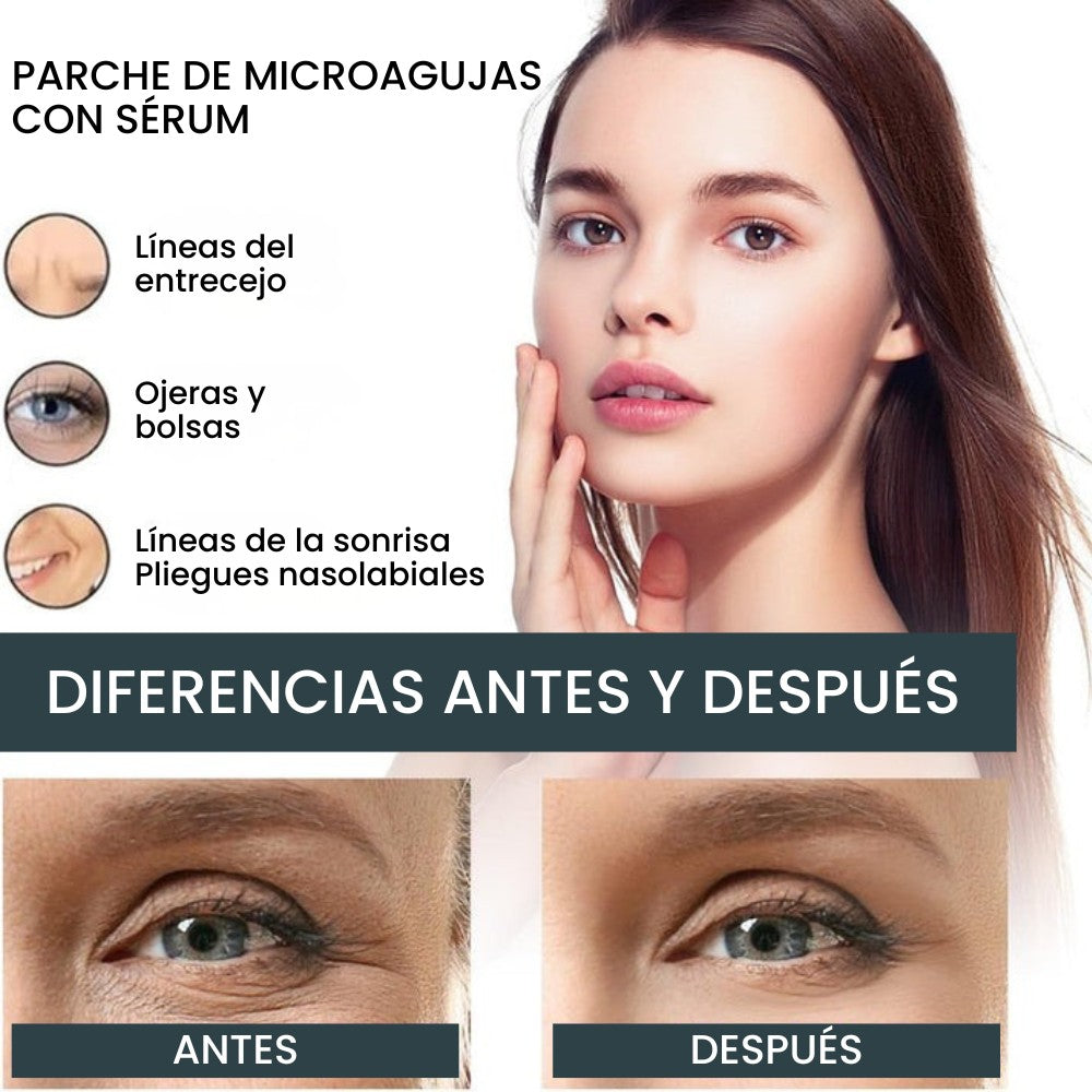 Parches MicroGlow