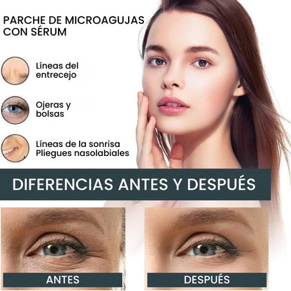 Parches MicroGlow