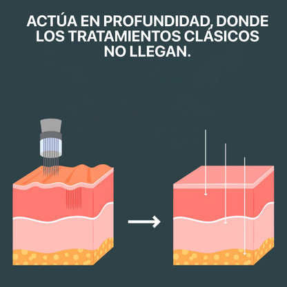 El Sistema de Microinfusión™ + Sérum extra de regalo